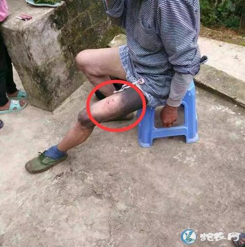 新澳天天开奖资料大全600TK和被蛇咬反抓蛇再遭咬与被蛇咬反抓蛇再遭咬伤